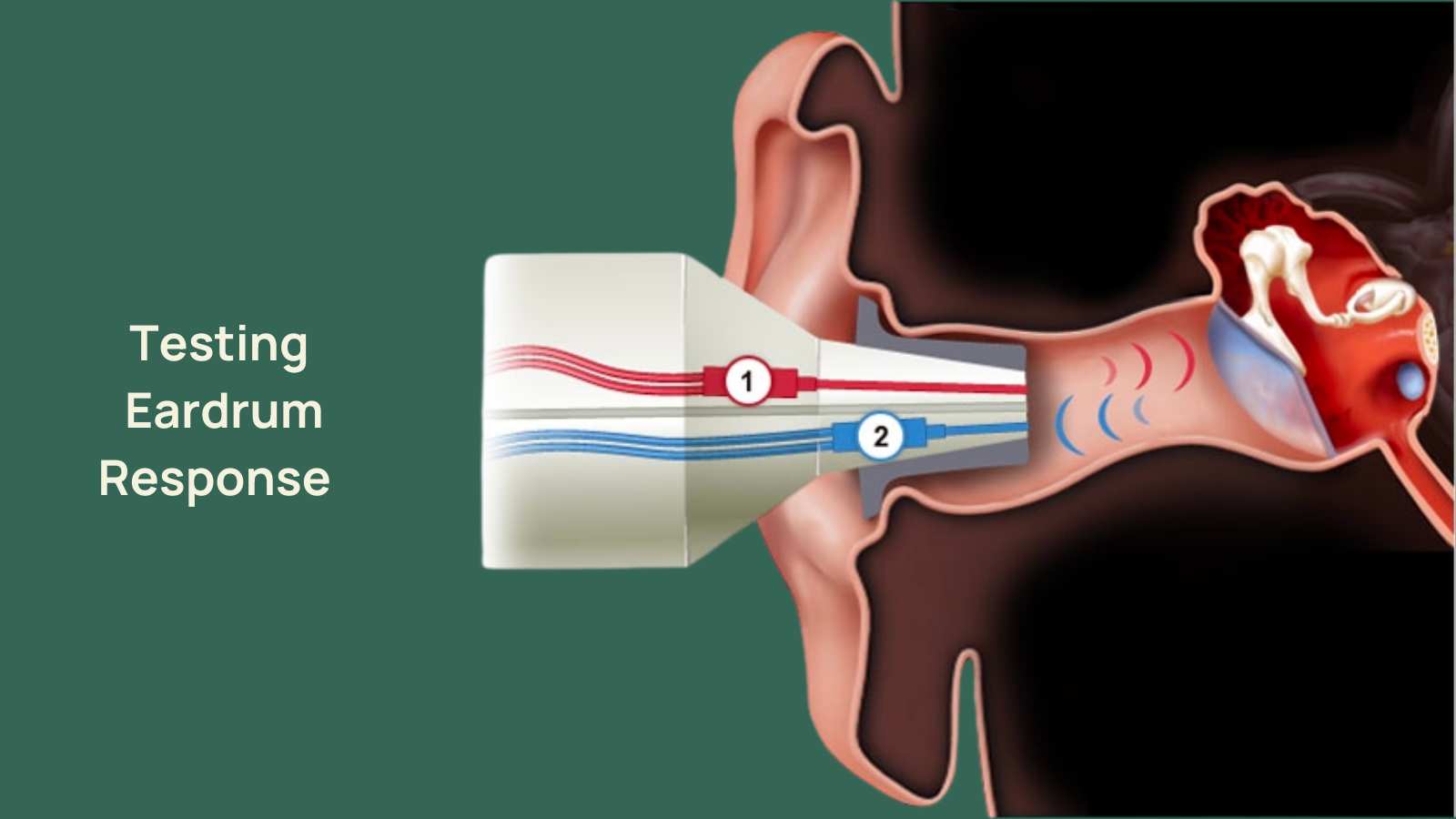 What Does a Tympanometry Test Do? Should I Get One?